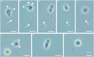 Stimulation and Isolation of Paraphysoderma sedebokerense (Blastocladiomycota) Propagules and Their Infection Capacity Toward Their Host Under Different Physiological and Environmental Conditions